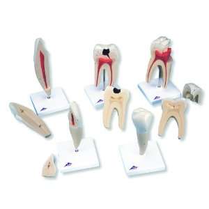 3B Scientific D10 Classic Tooth Model Series, 5 Models, 11.4 Height 