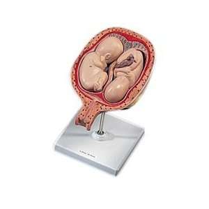 5th Month Twin Fetuses, normal position Pregnancy Model  